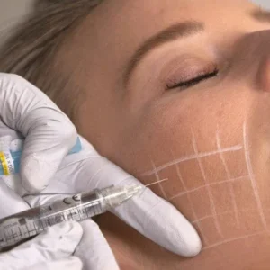 Mesotox & Skin Boosters