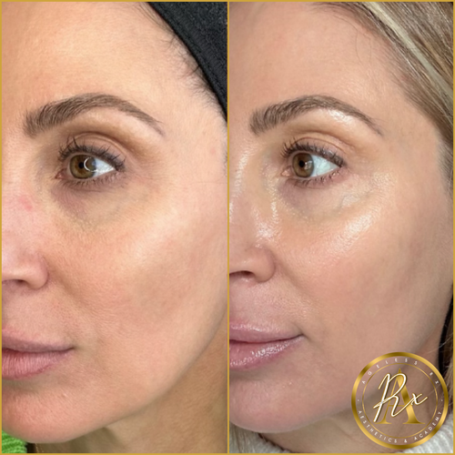 Glowtox ‘Glassy Skin’