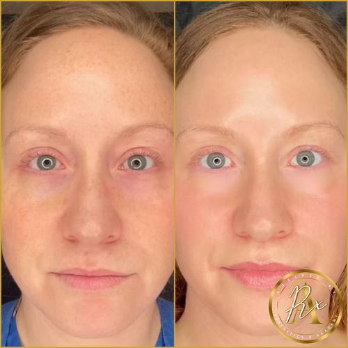 Glowtox ‘Glassy Skin’