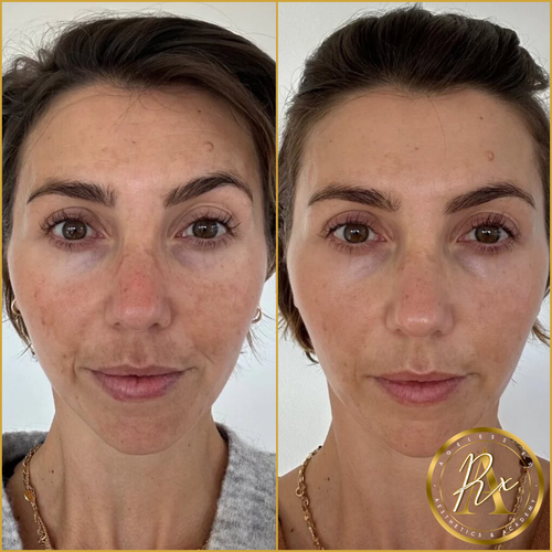 Signature Facials