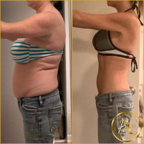 GLP-1 Weight Loss