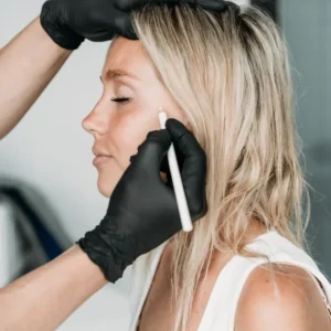 dermal FILLER 1 & 2