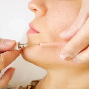 LEVEL 3 dermal FILLER